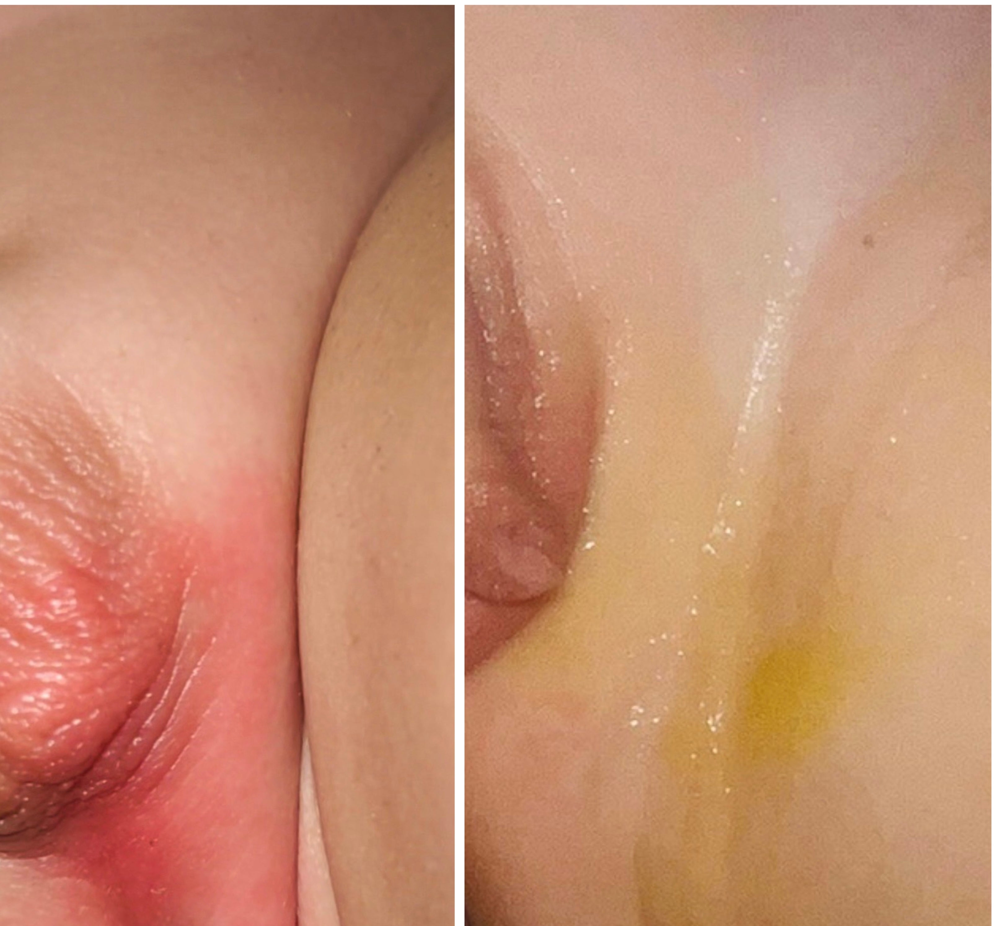 Healing Bee Wax Cream