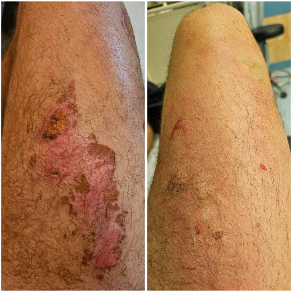 Healing Bee Wax Cream