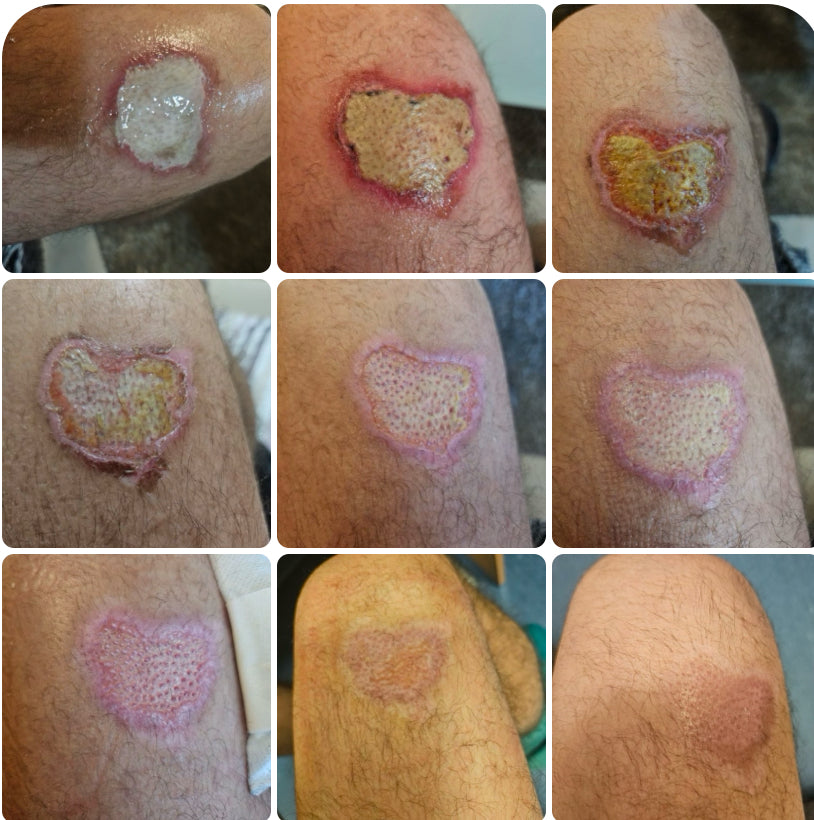 Healing Bee Wax Cream